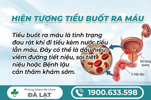 Hình ảnh minh họa